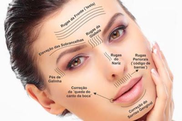 10 perguntas que todo mundo quer saber sobre a Harmonização Orofacial