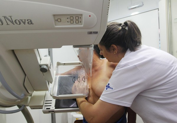 Câmara aprova acesso à fisioterapia pelo SUS para pacientes após tratamento de câncer de mama