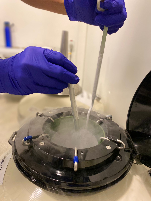 Congelamento de óvulos: conheça a técnica de preservação da fertilidade feminina e saiba quando ela é indicada