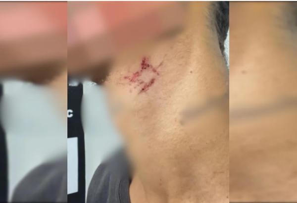 Escravo sexual é resgatado após passar mais de um ano em cárcere