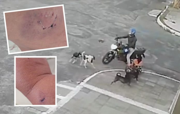 FICOU EM PÂNICO: Agente de saúde é atacada por seis cães em Feira de Santana