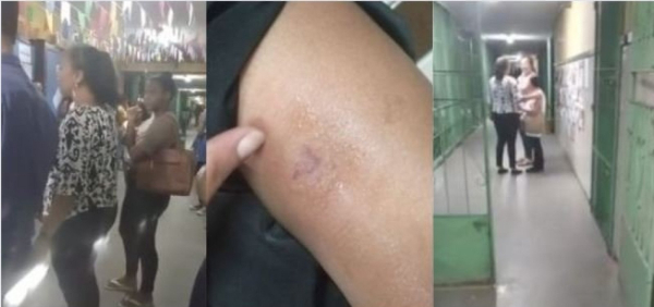 Guerra de fogos de artifícios atinge escola e deixa professora e duas estudantes feridas