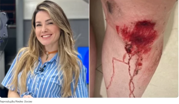 NA PORTA DE CASA: Repórter da Record fica ferida ao reagir a assalto em Ondina