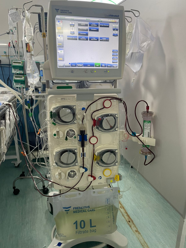 Tratamentos mais seguros e inovação tecnológica: Hospital de Salvador adquire nova máquina de hemodiálises para pacientes com problemas renais.