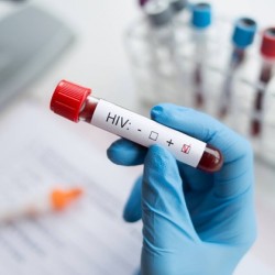 Sesab nega surto de HIV/Aids na Bahia entre jovens