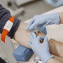 Câncer de intestino pode ser diagnosticado precocemente com o auxílio de exames laboratoriais  