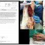 Feira de Santana: Paciente Mercia Rossi relata grave erro médico de equipe do Hospital Emec