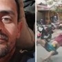 Homem espancado após acusação falsa de roubo tem morte encefálica em SP