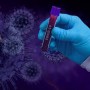 Laboratório de Feira de Santana registra aumento de mais de 500% na busca por testes de covid-19 