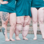 Médicos alertam para risco de distúrbio na menopausa causado pela lipedema