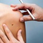 Pandemia fez número de exames para detectar câncer de pele cair 63% na Bahia