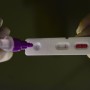 Pesquisadores identificam método capaz de prever gravidade da covid-19